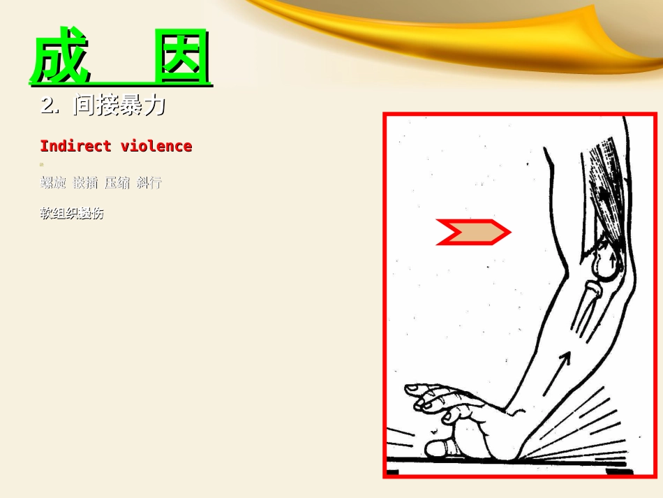 骨科实习小讲课课件_第7页