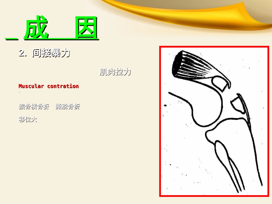 骨科实习小讲课课件_第8页