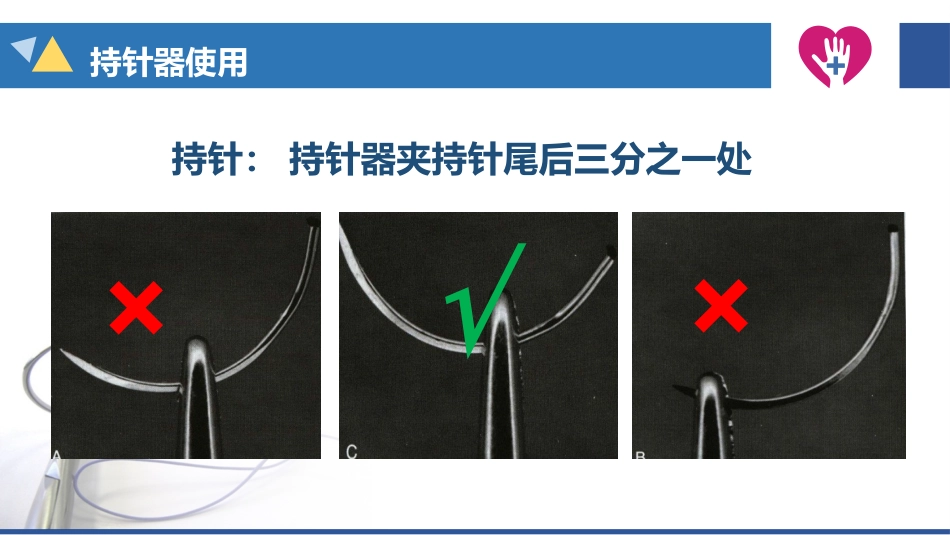 缝合与拆线_第10页