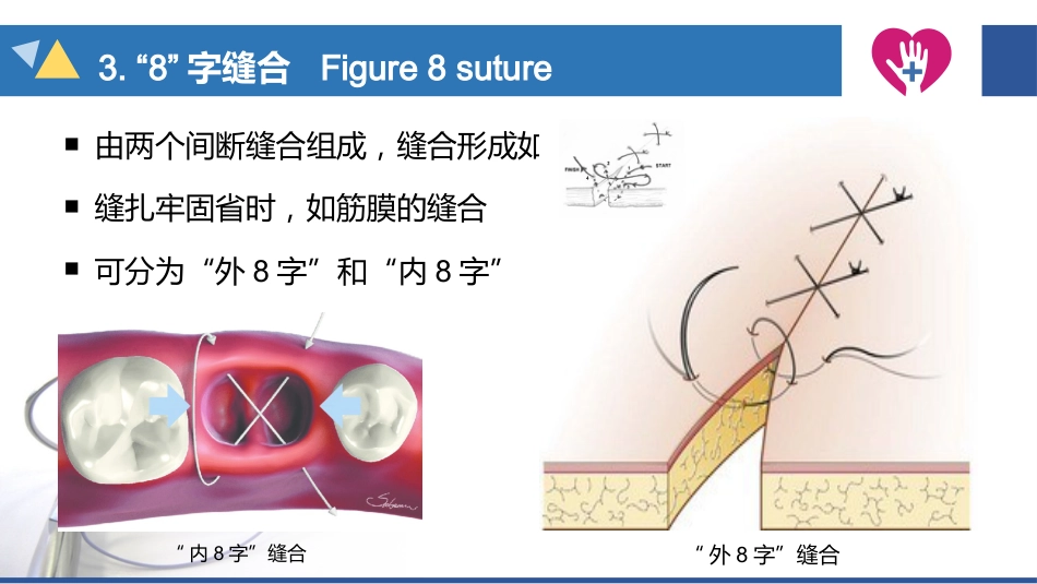 缝合与拆线_第15页