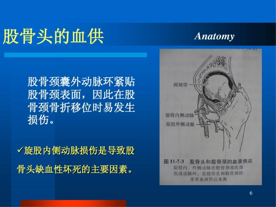 股骨颈骨折ppt课件_第6页