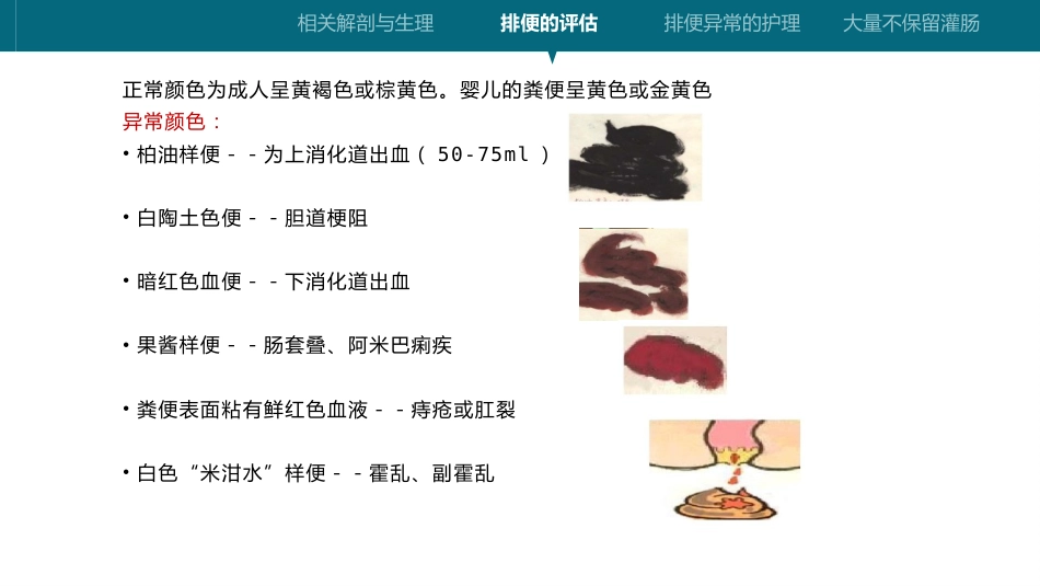 灌肠操作技术_第6页