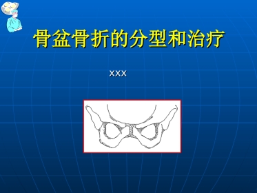 骨盆骨折的分型和治疗