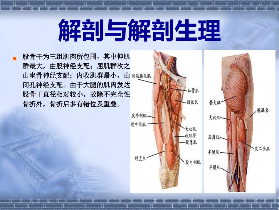 股骨干骨折_第4页
