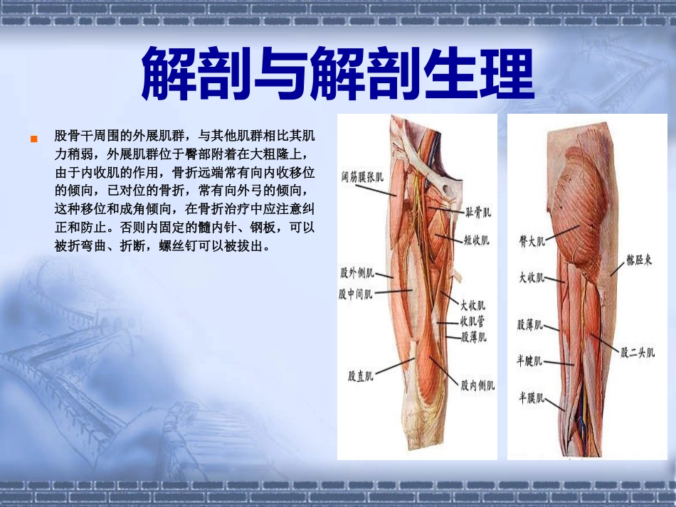 股骨干骨折_第5页
