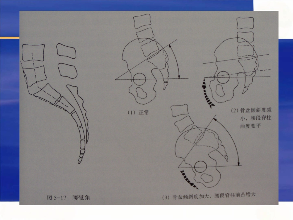 骨盆的临床解剖_第7页