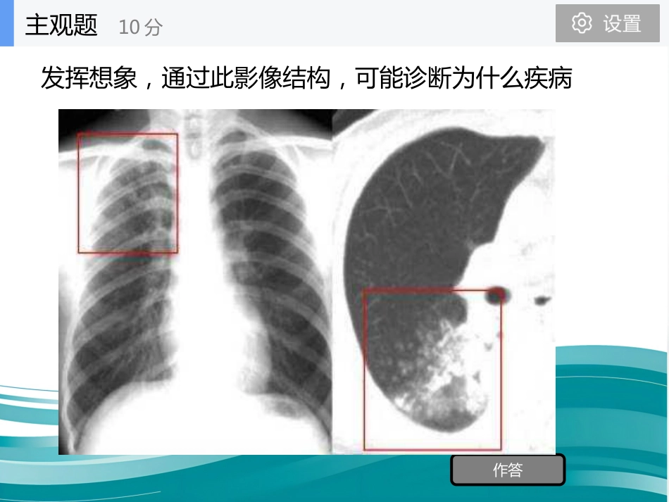 病理学 肺炎PPT课件_第2页