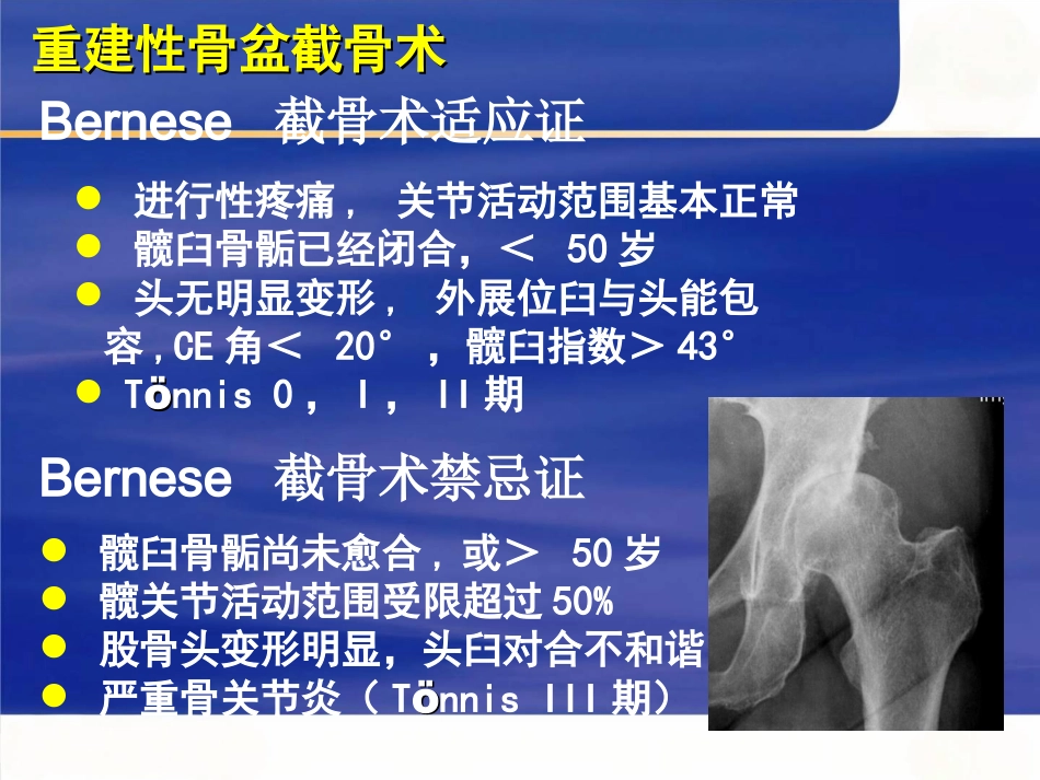 成人髋关节发育不良的手术选择_第10页