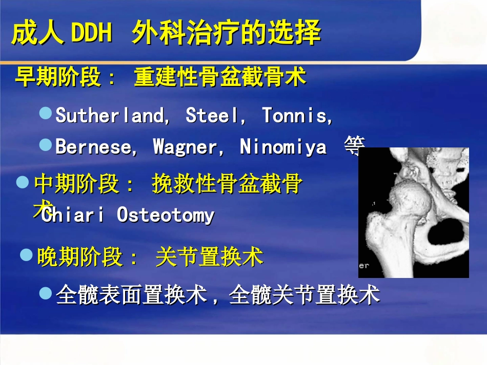 成人髋关节发育不良的手术选择_第4页