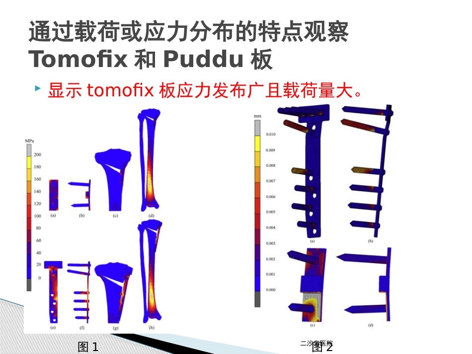HTO并发症及预防对策_第12页