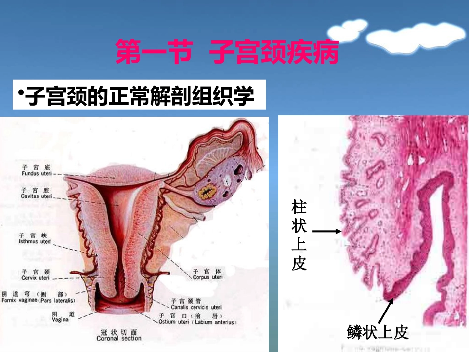 病理学13生殖系统和乳腺疾病_第4页