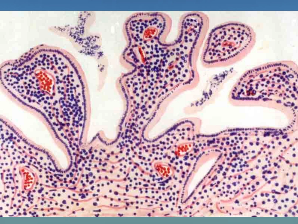 病理学13生殖系统和乳腺疾病_第7页
