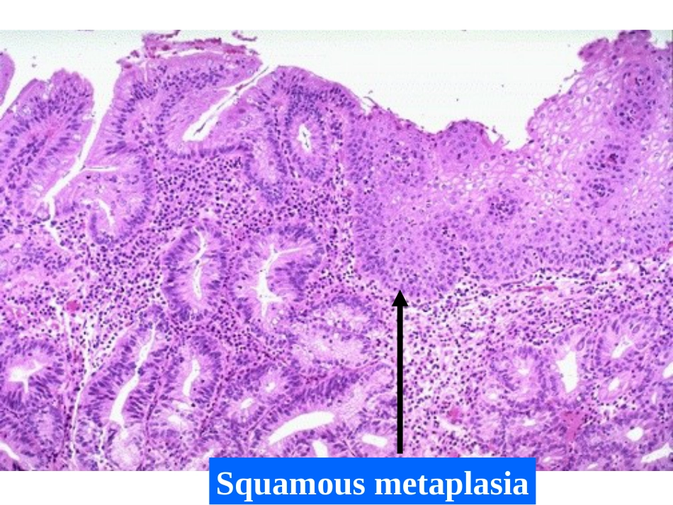 病理学13生殖系统和乳腺疾病_第8页