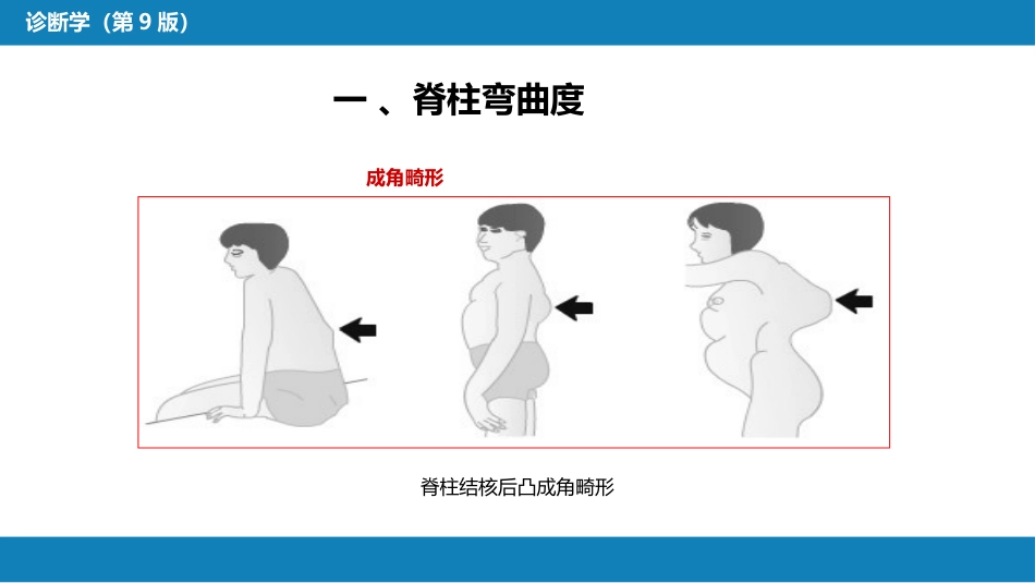 第三篇 体格检查 第八章 脊柱与四肢检查_第10页