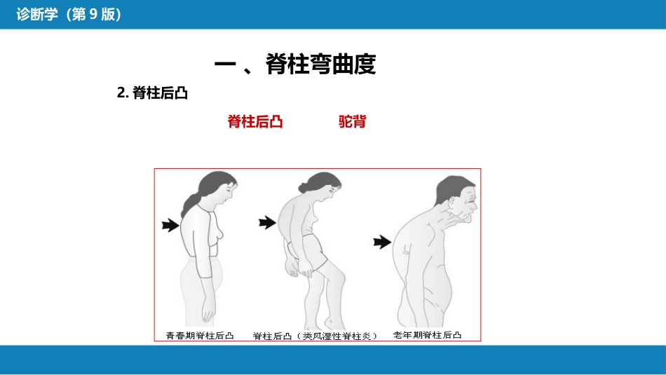 第三篇 体格检查 第八章 脊柱与四肢检查_第8页