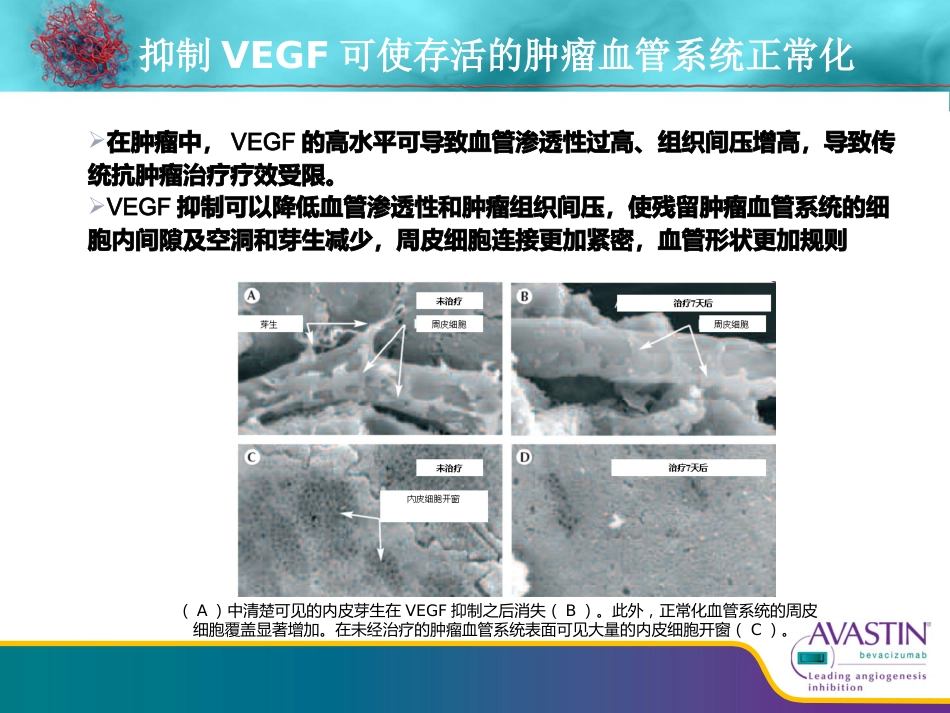 贝伐珠单抗从基础到临床_第12页