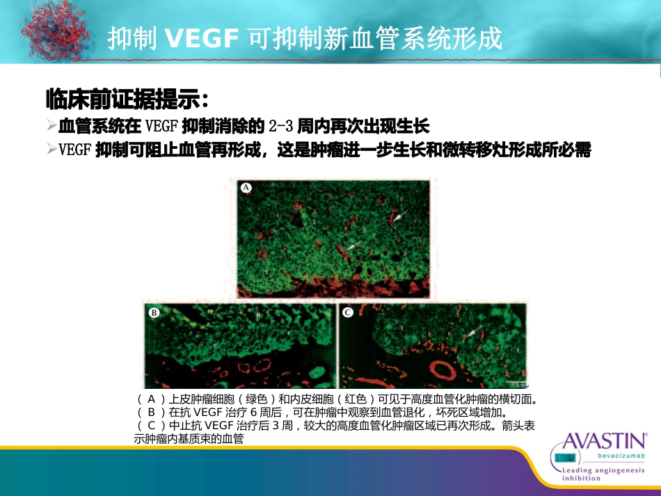 贝伐珠单抗从基础到临床_第13页