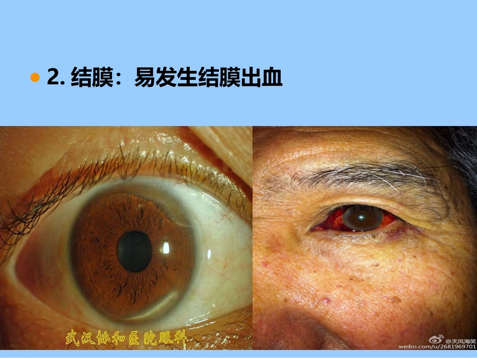 老年人各系统的老化改变_第4页