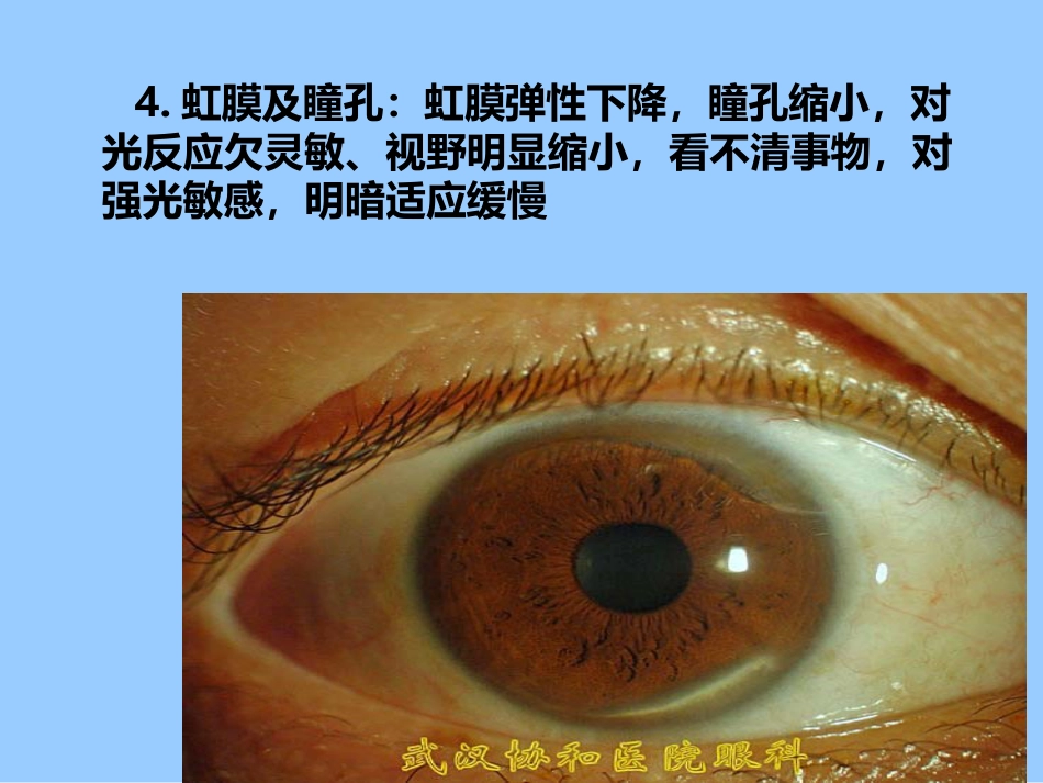 老年人各系统的老化改变_第6页