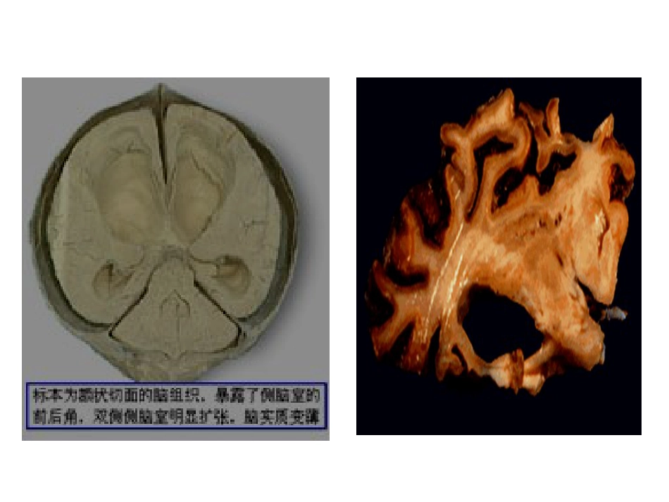 病理学绪论_第14页