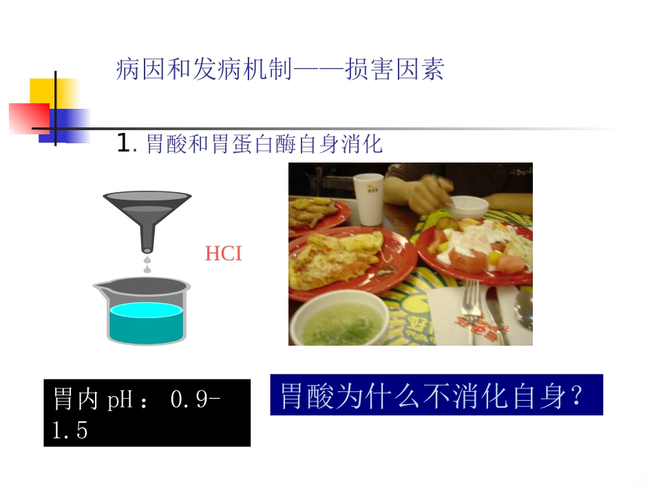 老年消化性溃疡PPT课件_第14页