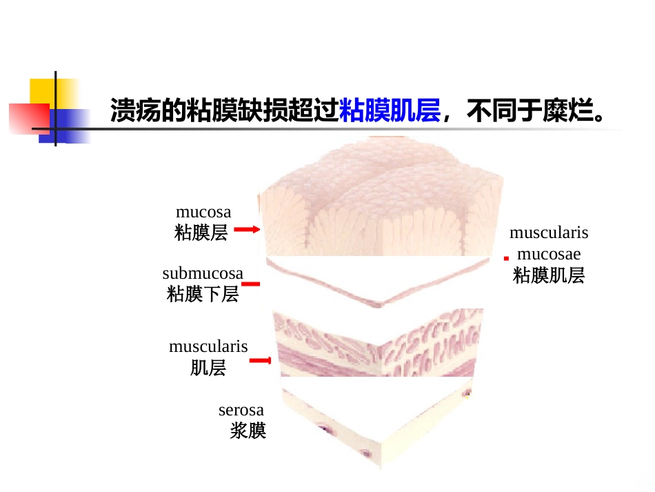老年消化性溃疡PPT课件_第6页