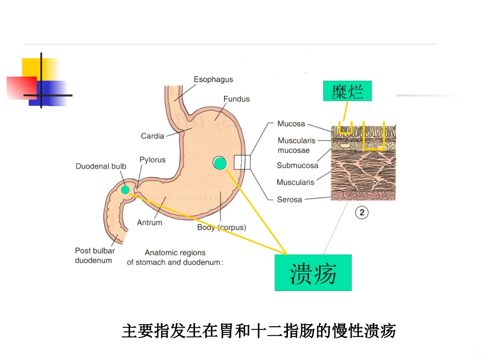 老年消化性溃疡PPT课件_第7页
