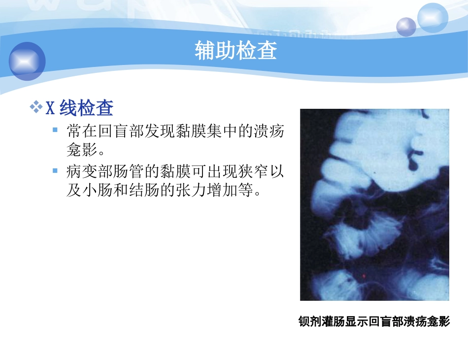 肠白塞病的临床分析PPT课件_第13页