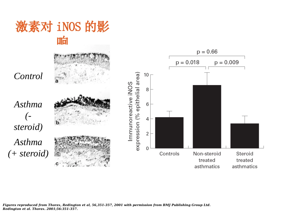 FeNO临床应用_第10页