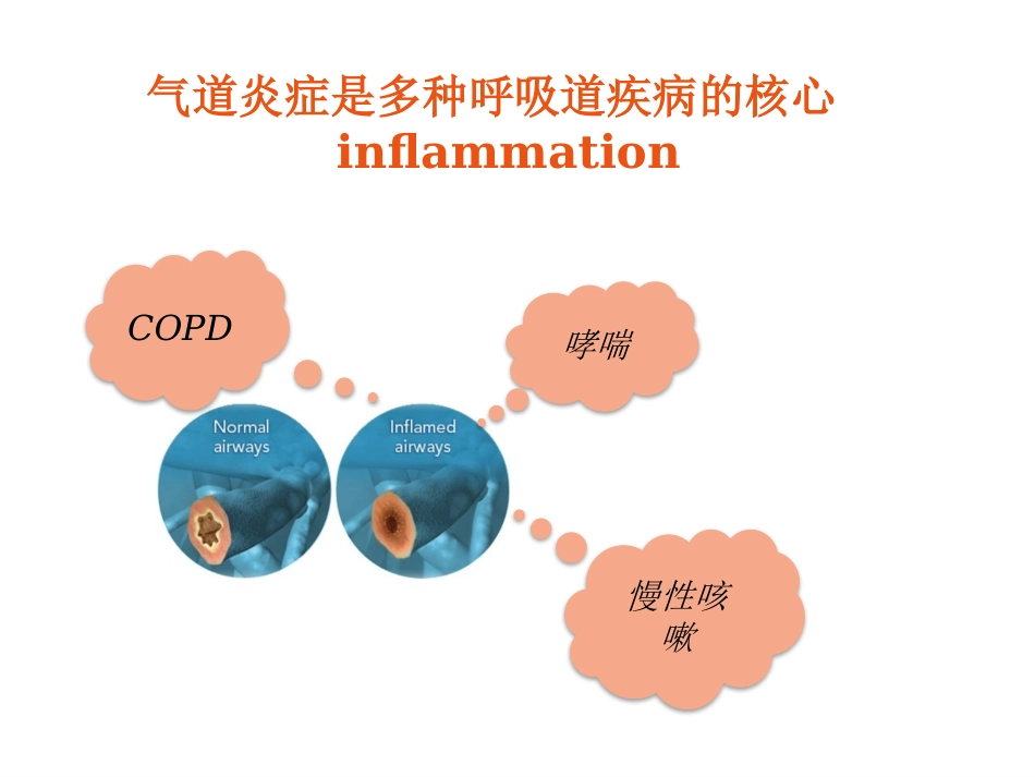 FeNO临床应用_第4页