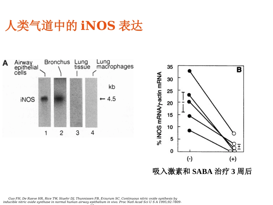 FeNO临床应用_第9页
