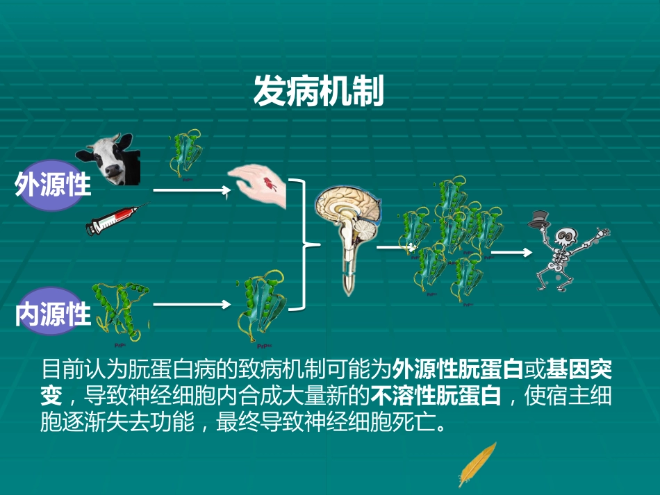 CJD临床诊断_第9页