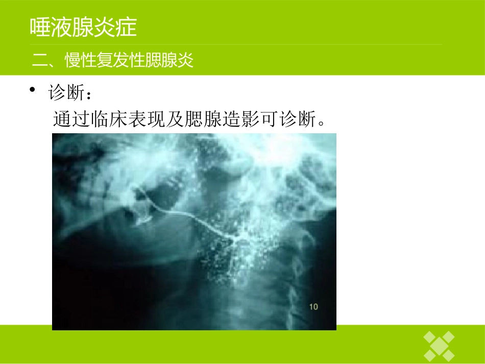 高校临床医学课件唾液腺常见疾病_第11页