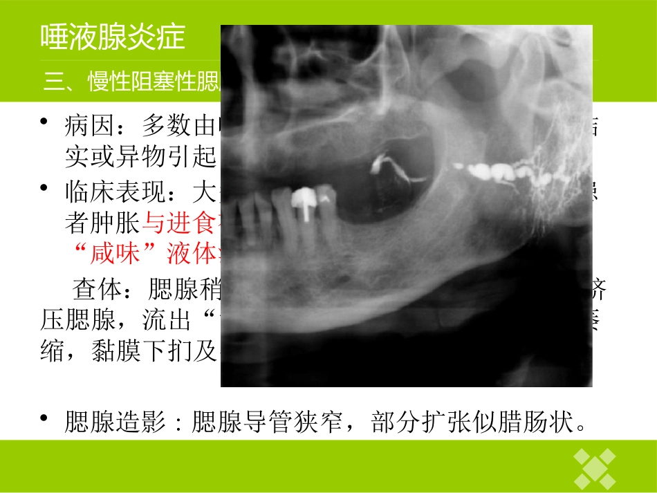 高校临床医学课件唾液腺常见疾病_第14页