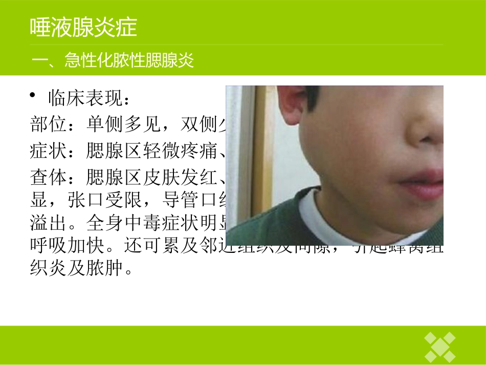 高校临床医学课件唾液腺常见疾病_第6页