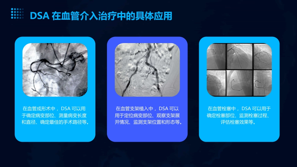 DSA的临床应用教学讲义PPT_第10页