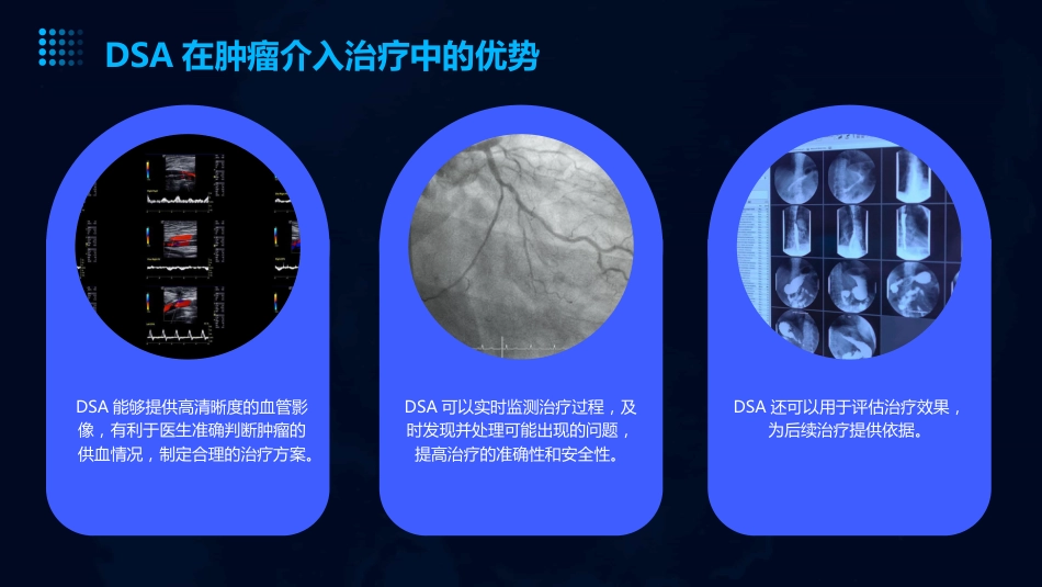 DSA的临床应用教学讲义PPT_第13页