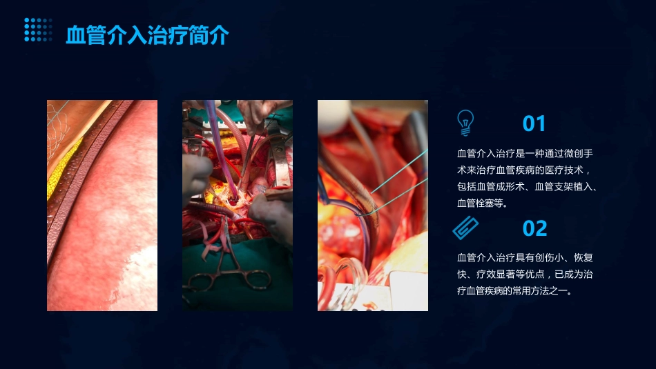 DSA的临床应用教学讲义PPT_第8页