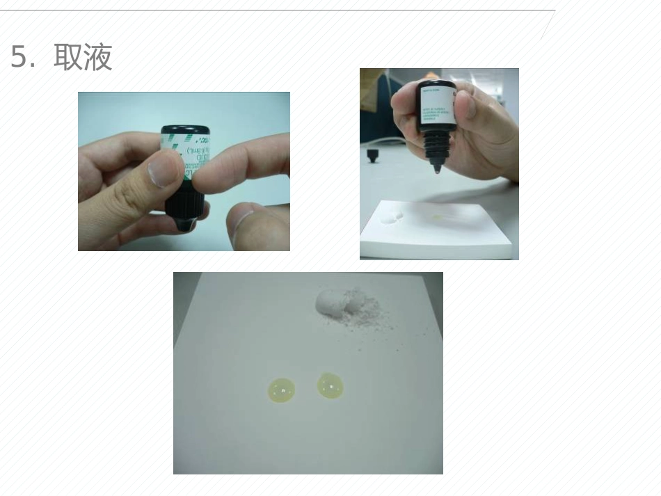 玻璃离子的临床使用的技巧与注意事项_第11页