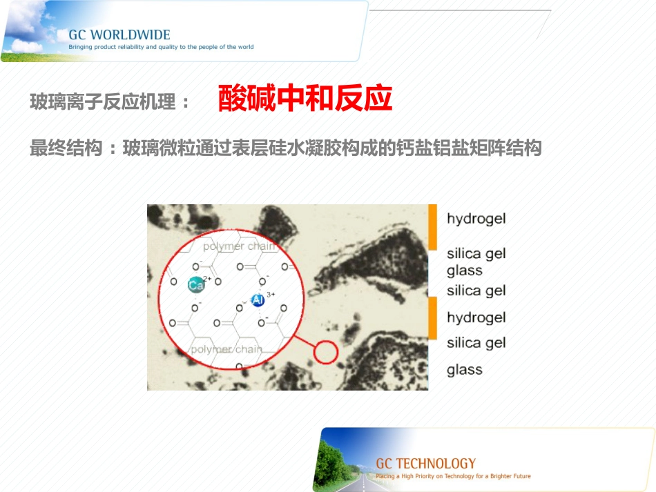 玻璃离子的临床使用的技巧与注意事项_第5页