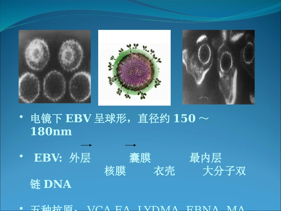 EB病毒的临床意义_第8页
