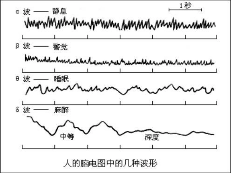 老年人睡眠障碍的特点与诊治_第4页