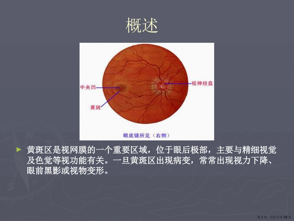 老年性黄斑变性课件课件_第2页