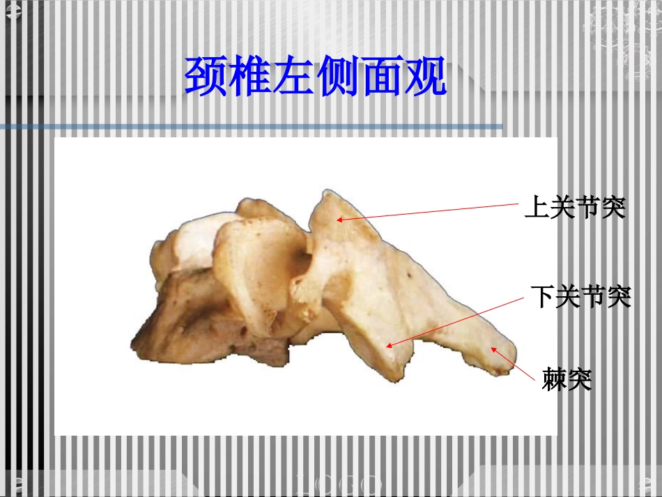 骨科-颈椎病详解_第12页