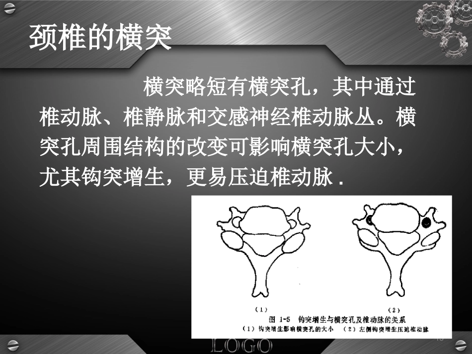 骨科-颈椎病详解_第13页