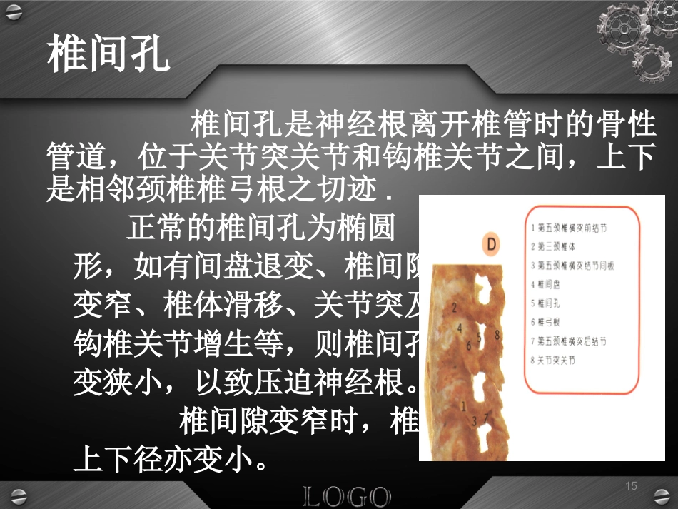 骨科-颈椎病详解_第15页