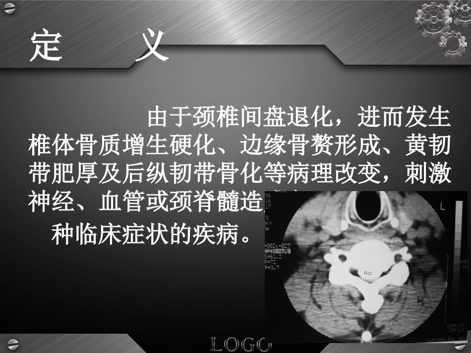 骨科-颈椎病详解_第4页