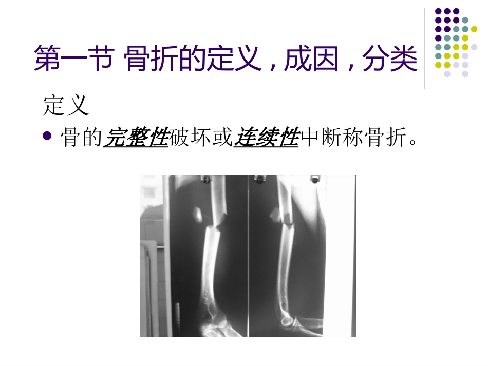 骨科-骨折总论-_第5页