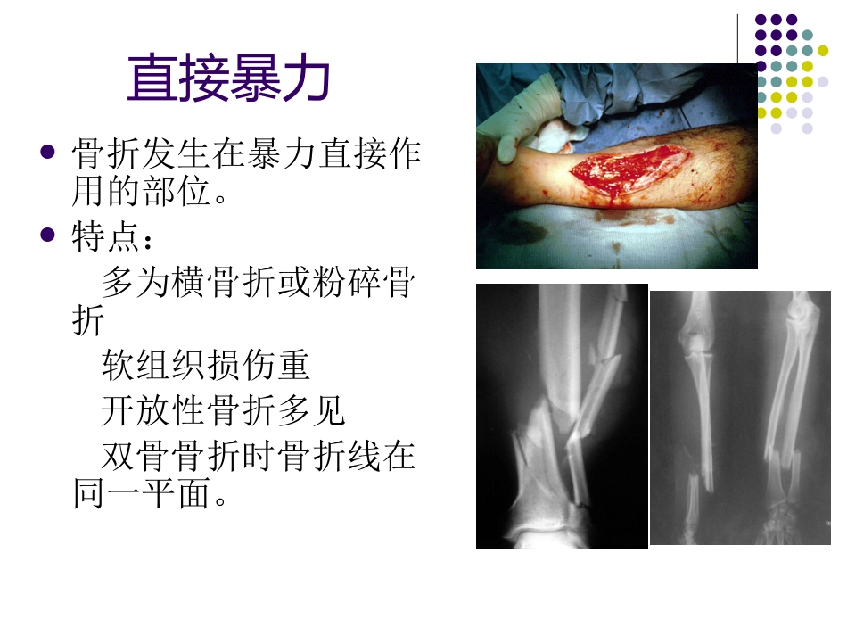 骨科-骨折总论-_第7页