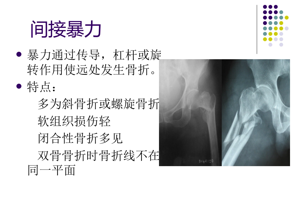 骨科-骨折总论-_第8页